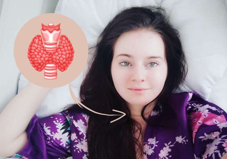 Struma a štítná žláza